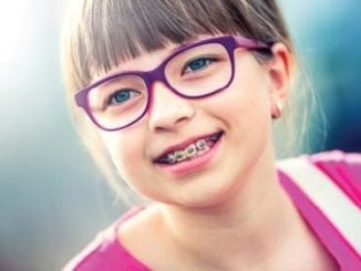 Myths and Truths about Caring for your Braces | Birminghamparent.com