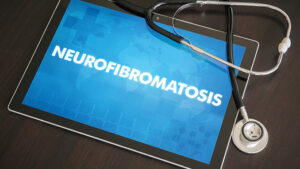 The Neurofibromatosis Normal|Phillip Moss