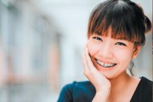 Do-It-Yourself Teeth Straightening | Birminghamparent.com